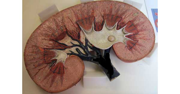 Model of a human kidney (DoD/Sandra Lea Abrams)