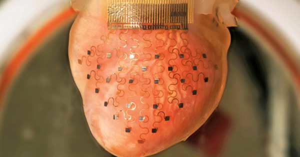 Heart Devices and Desires